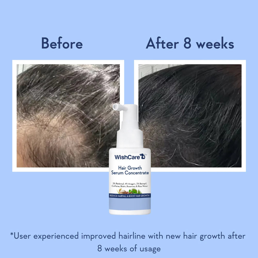 WishCare | Hair Growth Serum Concentrate