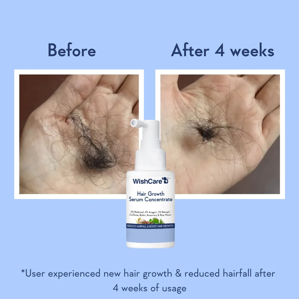 WishCare | Hair Growth Serum Concentrate