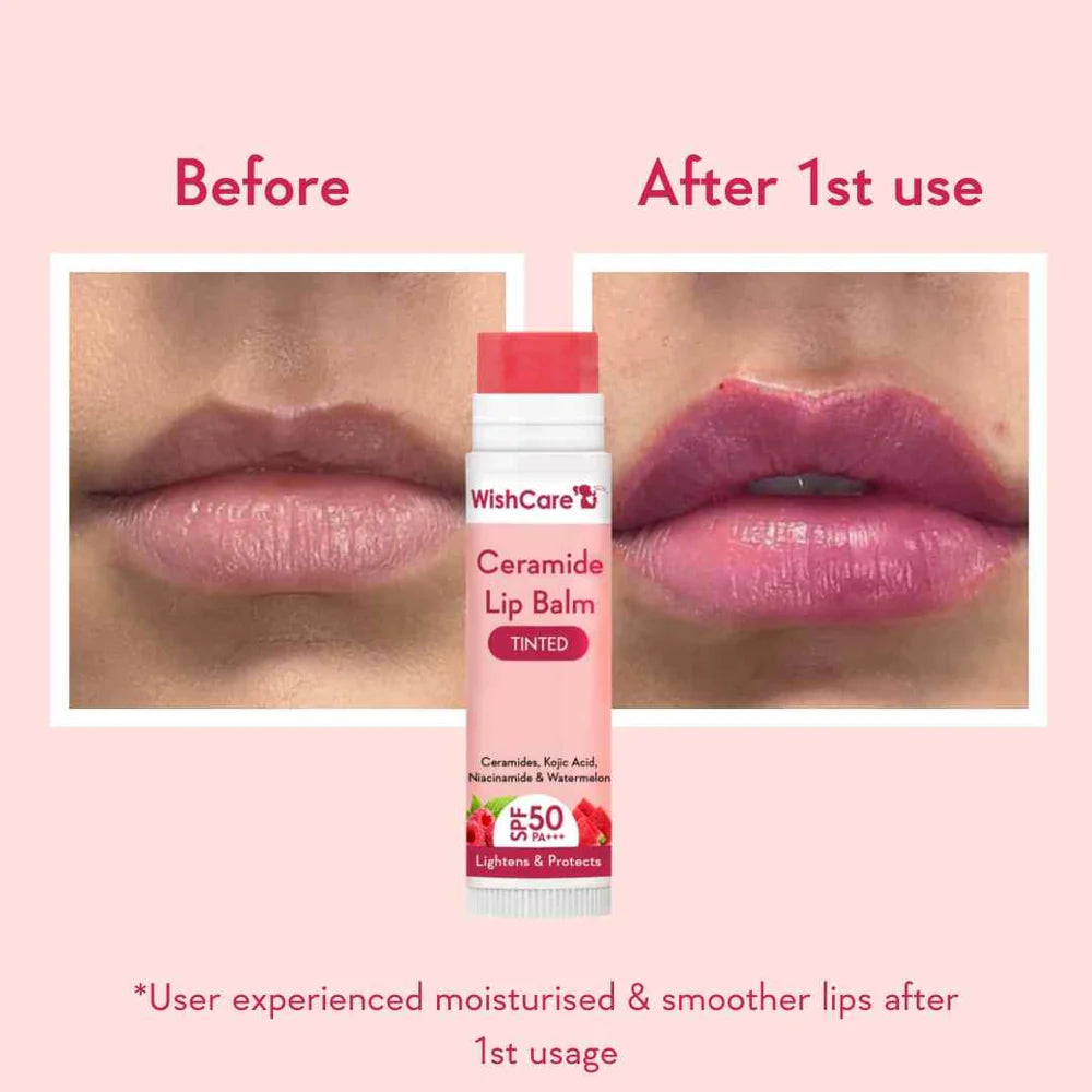WishCare | Ceramide Lip Balm with SPF 50 PA+++ (Tinted) SPF Infused Lip Balm for Lip Brightening | 5g